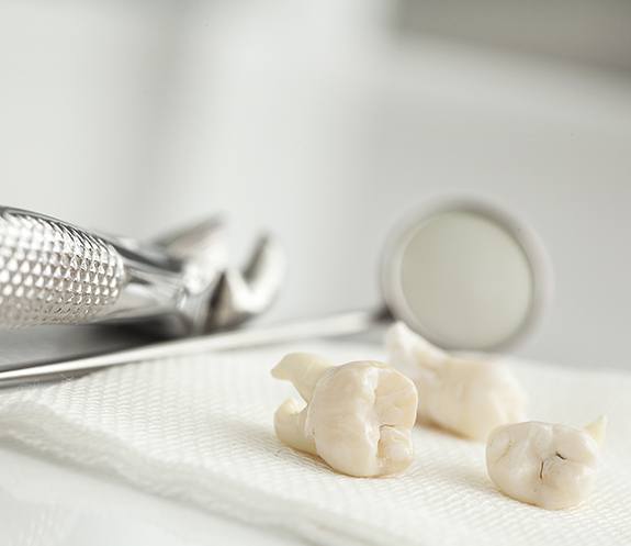 Several teeth on tray after tooth extractions