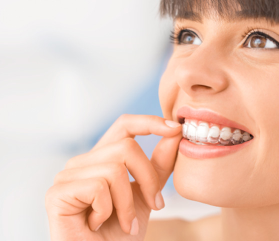 Nose-to-neck ¾ profile view of woman with brown eyes touching Invisalign over upper teeth