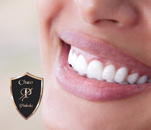 Patient with healthy smile thanks to chao pinhole surgical technique treatment