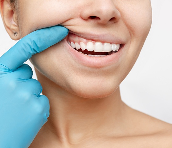 Woman using gloved hand to lift her lip and show healthy gums
