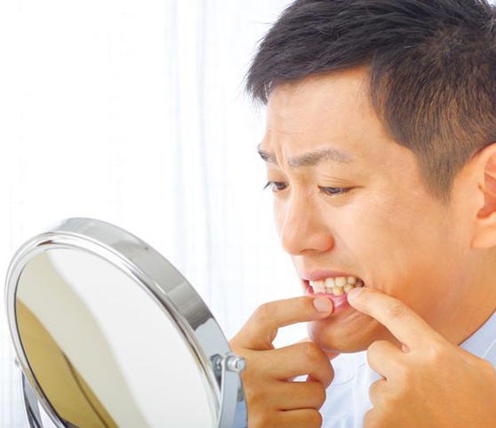 Man looking in mirror, concerned about gum disease
