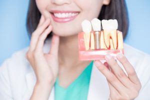 Patient holding a model of dental implants.